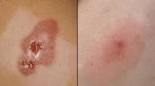 🩸 Diabetic Wounds Treatment Cream photo review